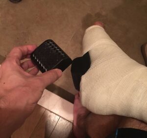 ヒール付ギプス