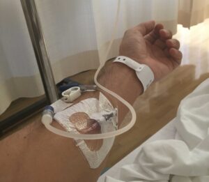 アキレス腱断裂手術後の点滴