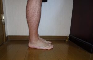 アキレス腱リハビリ 垂直立ち