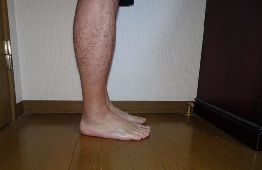 アキレス腱リハビリ　垂直立ち