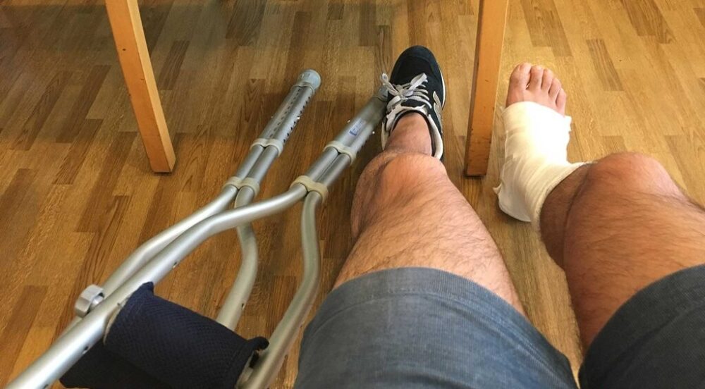 アキレス腱ギプスシーネと松葉杖