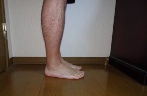 アキレス腱リハビリ 垂直立ち